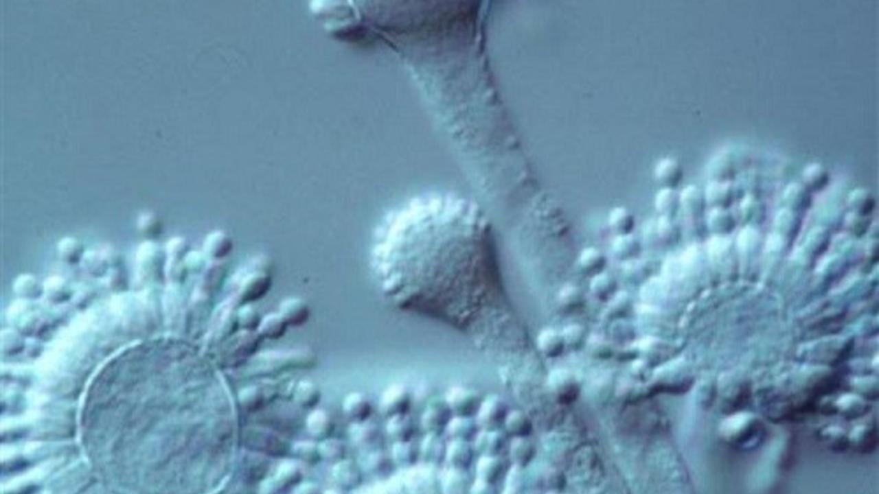 Yeast and fungal infections; The hidden culprit ?