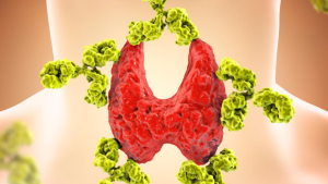 Perfect thyroid results - Perhaps not...