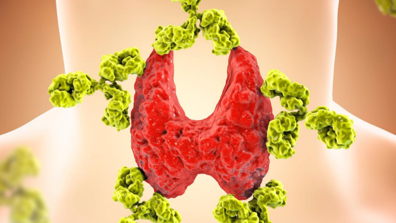 Perfect thyroid results? Perhaps not…