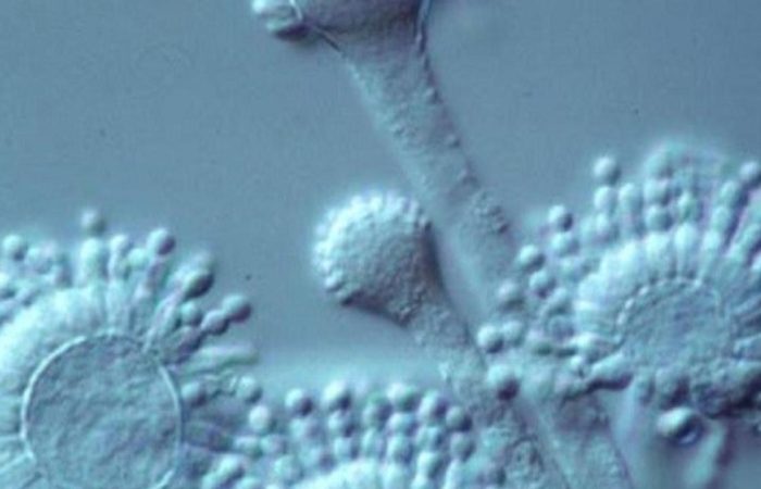 Fungal infections and how to treat them