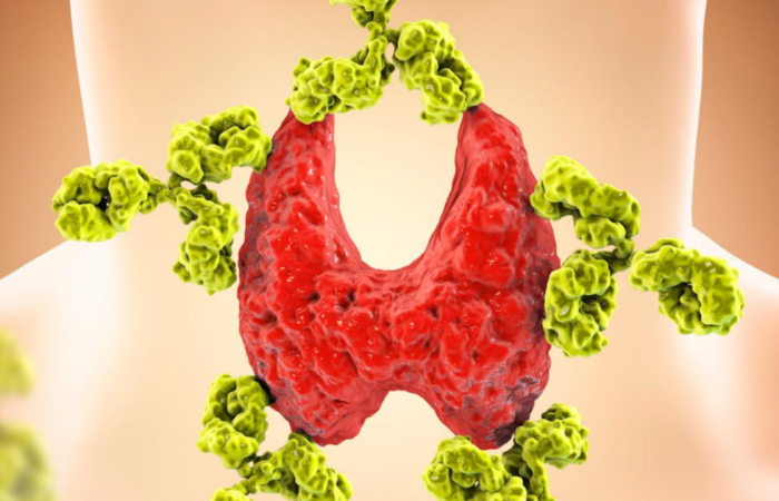 Perfect thyroid results - Perhaps not...